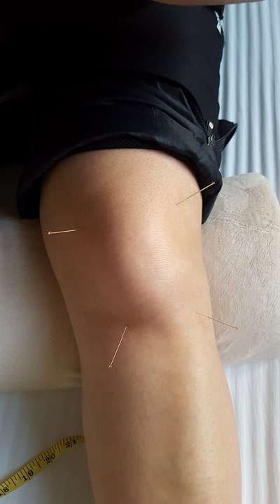 Touch Soft Tissue Therapies photo